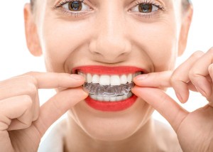 Dr. Meissl | INVISALIGN®