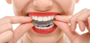 Dr. Meissl | INVISALIGN®